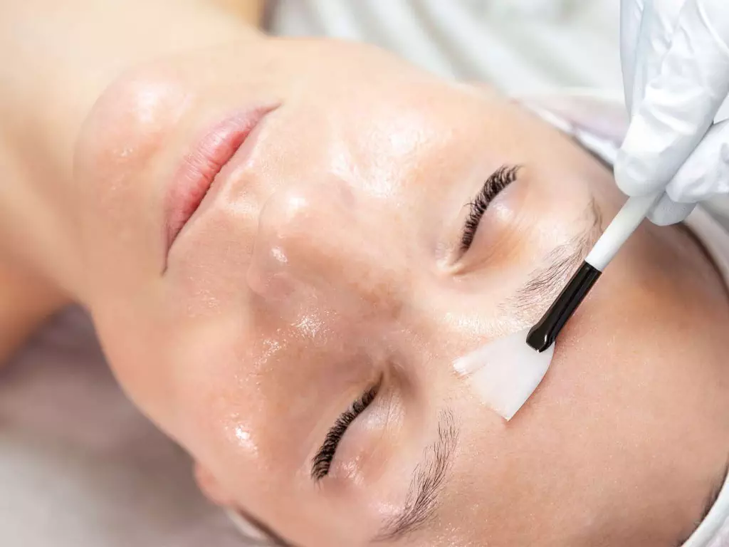 tsbr-body-peels-feature-img-v1